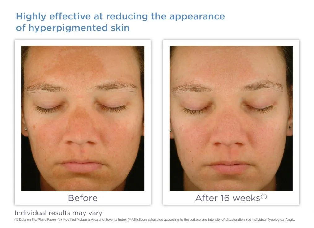 Glytone Enhance Brightening Complex