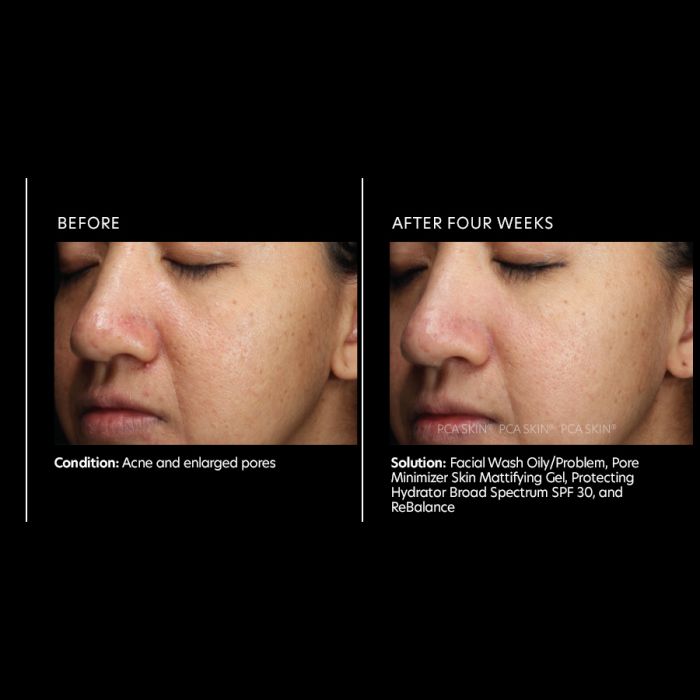 PCA Skin Pore Minimizer Skin Mattifying Gel