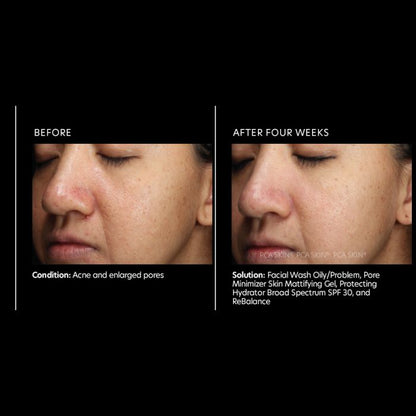 PCA Skin Pore Minimizer Skin Mattifying Gel